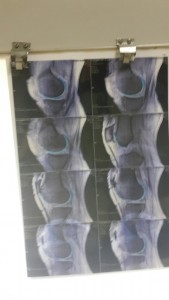 Cells signal halt to UK scientist's Knee Pain