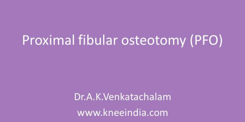 Proximal Fibular Osteotomy India
