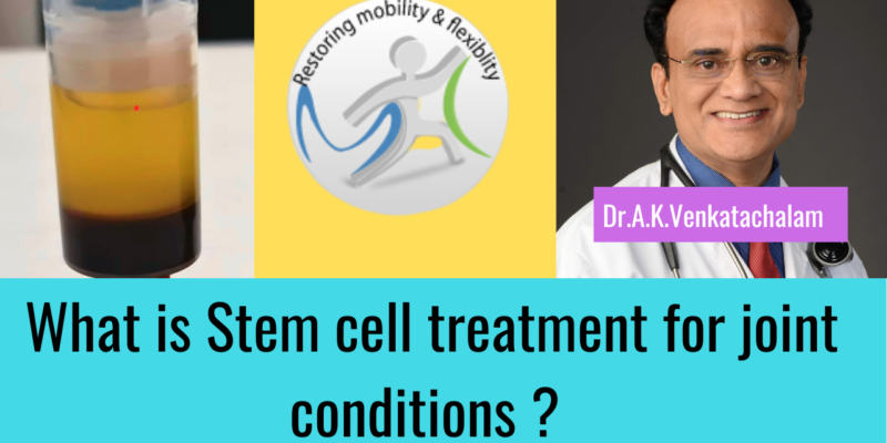 Stem cell treatment knee arthritis Chennai
