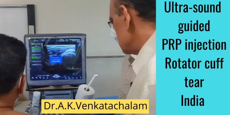 PRP injection ultra-sound guidance rotator cuff tear India