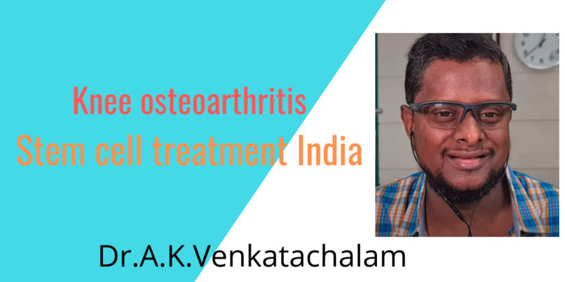 Knee osteoarthritis stem cell treatment India