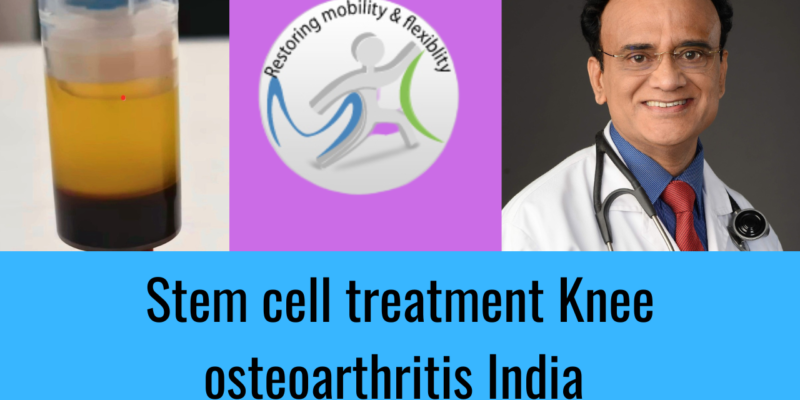 Knee Osteoarthritis stem cell treatment Chennai India