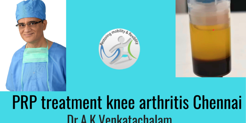 PRP therapy knee arthritis Chennai