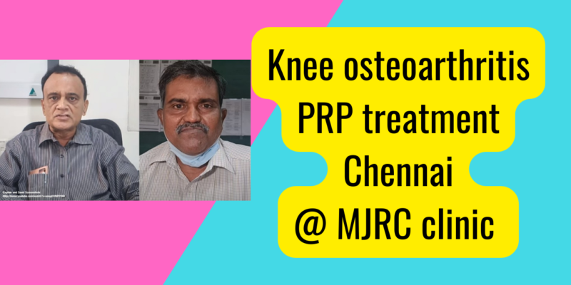 Knee osteoarthritis treatment with PRP in Chennai