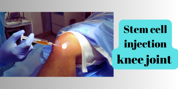 Evidence for Stem cell treatment knee osteoarthritis India