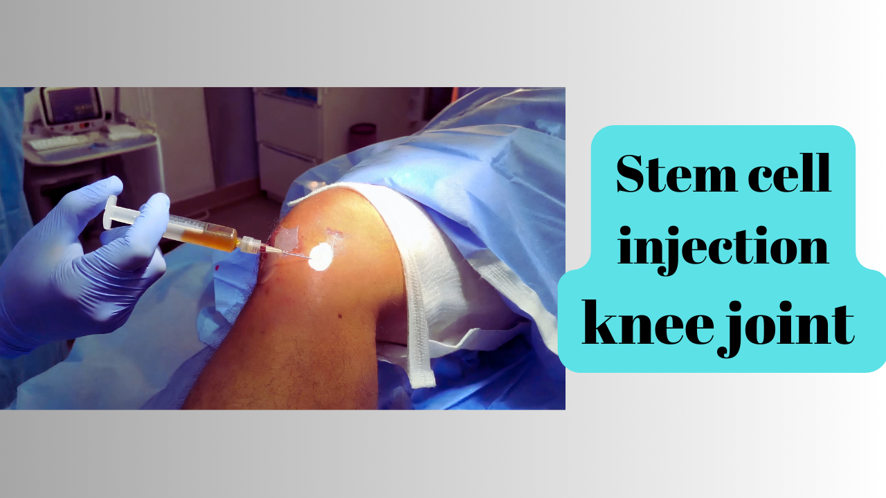 Evidence for Stem cell Treatment Knee Osteoarthritis India