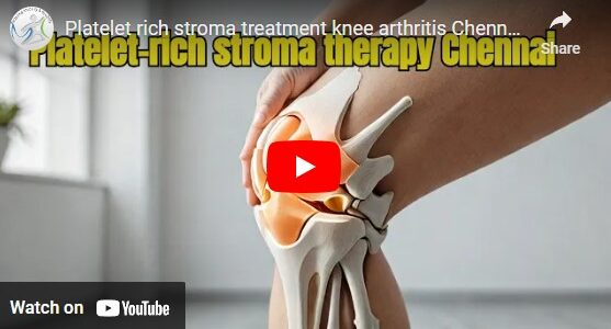 Platelet rich stroma treatment knee arthritis India