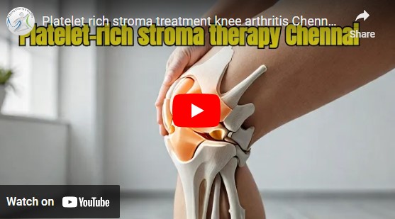 Platelet rich stroma treatment knee arthritis India