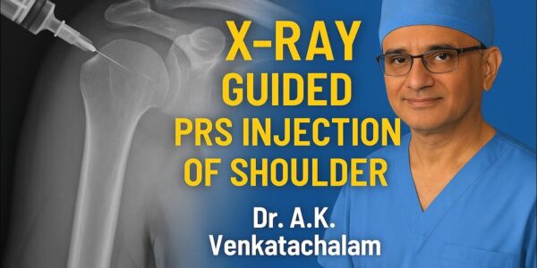 PRS treatment shoulder arthritis Chennai